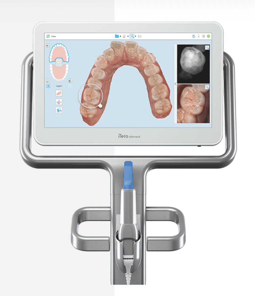 Orthodontic diagnostic technology